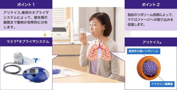 ポイント1 アリケイス®専用のネブライザシステムによって、肺末梢の肺胞まで薬剤が効率的に分布します。ポイント2 独自のリポソーム技術によって、マクロファージへの取り込みを促進します。