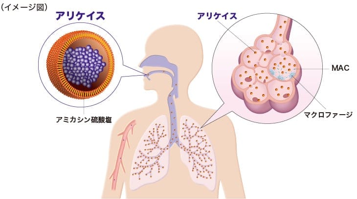 アリケイス®のリポソーム技術によるアミカシンの肺末梢への送達イメージ図