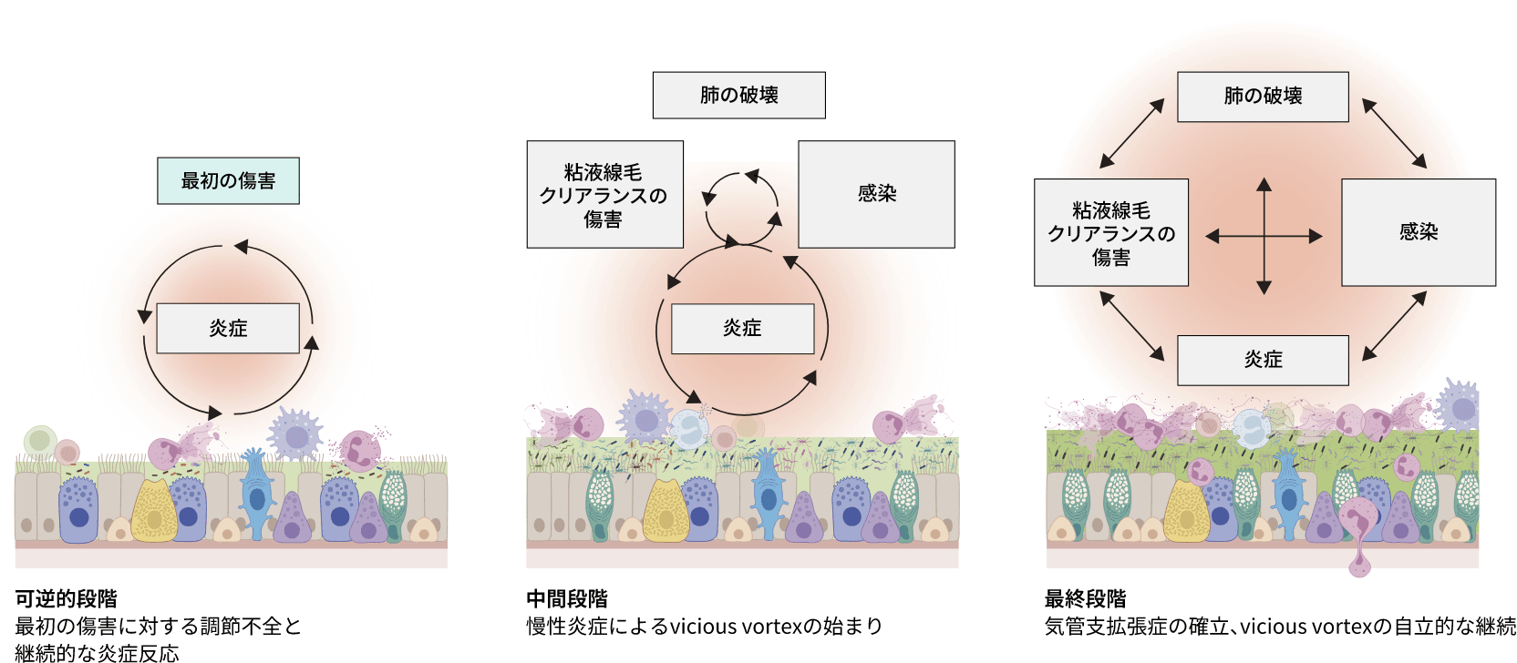 炎症の役割